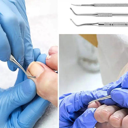 Professional Dual-ended Ingrown Toenail Lifter & Cleaner, 3pcs Stainless Steel Nail Trimmer Double Head Nail Scraper Nail Clippers Toe Fixer Pedicure Nail Tool Set, Nail Art Tool
